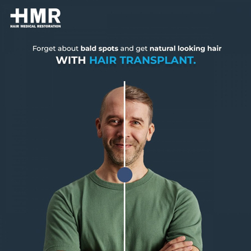 Slider image (3) Hair Medical Restoration (HMR)